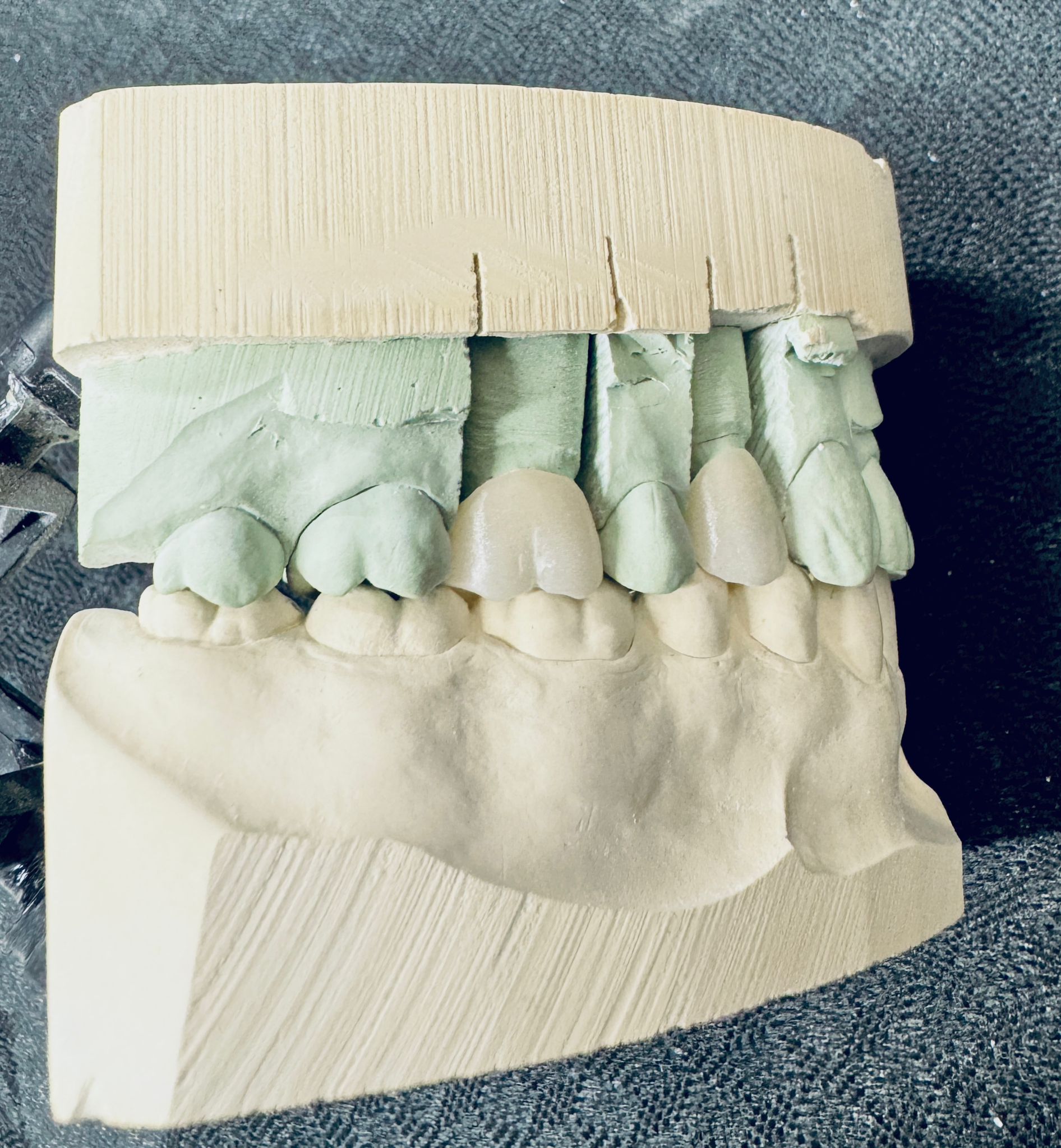 Case result 1