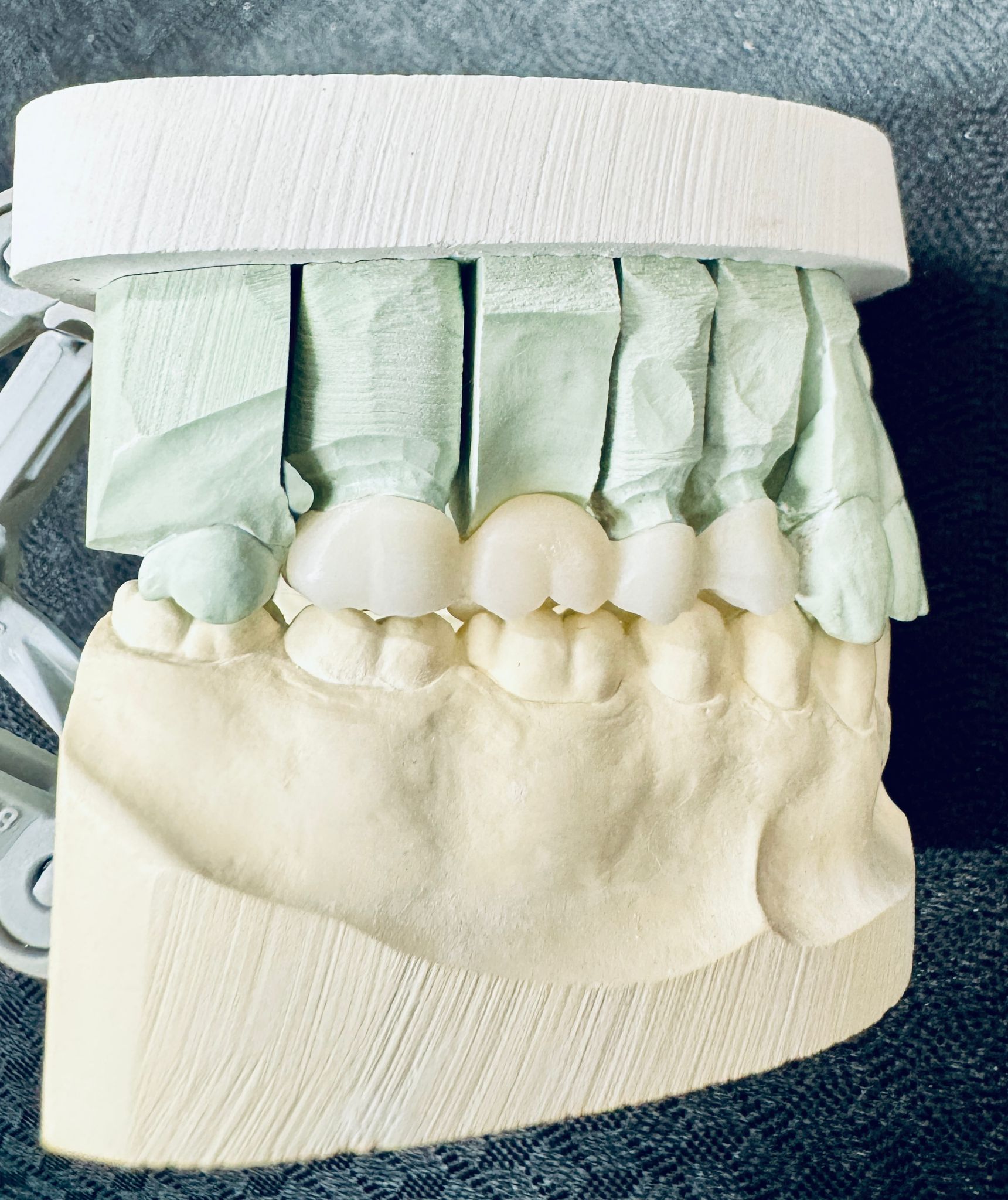 Case result 2